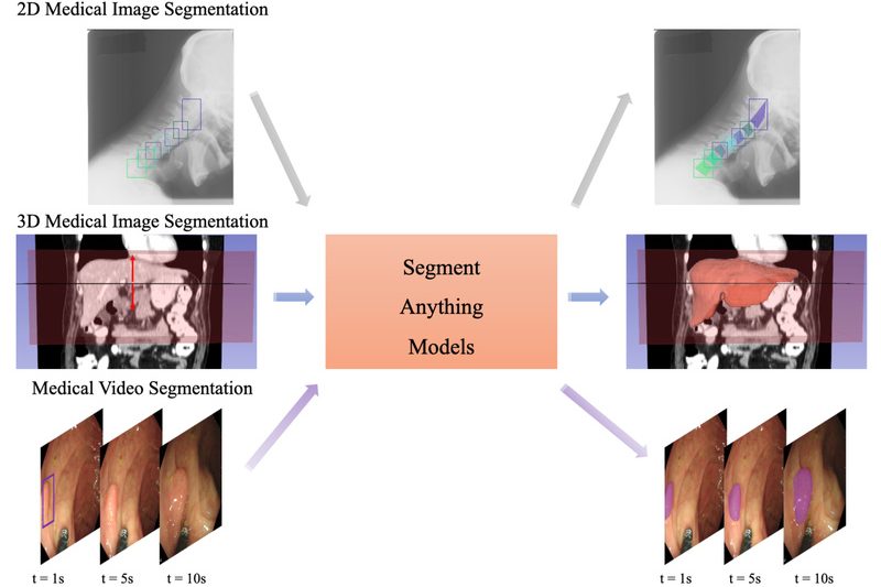 MedSAM: Accurate, Prompt-Based Medical Image Segmentation Out of the Box